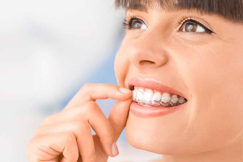 Invisalign in Tucson